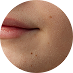 NOKAクリニック